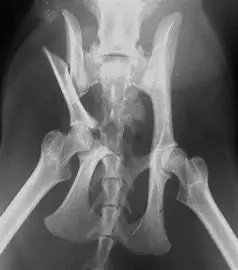 Fracture du bassin et disjonction sacro-iliaque