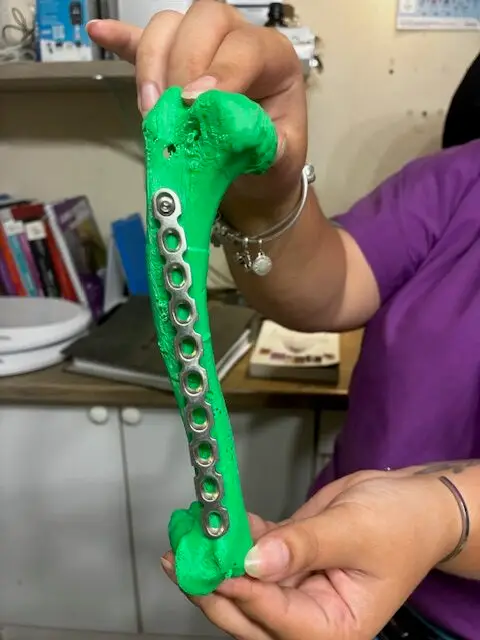 os imprimé "réparé"